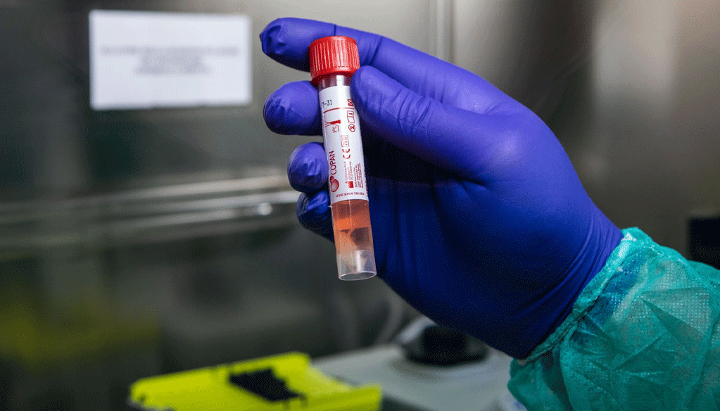 1 202 nouvelles infections et 18 décès ce dimanche 6 février 1 202 nouvelles infections et 18 décès ce dimanche 6 février