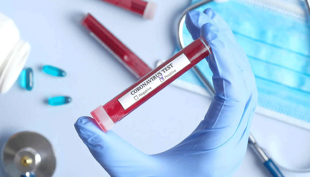 22 nouvelles infections et aucun décès ce samedi 24 Septembre 22 nouvelles infections et aucun décès ce samedi 24 Septembre