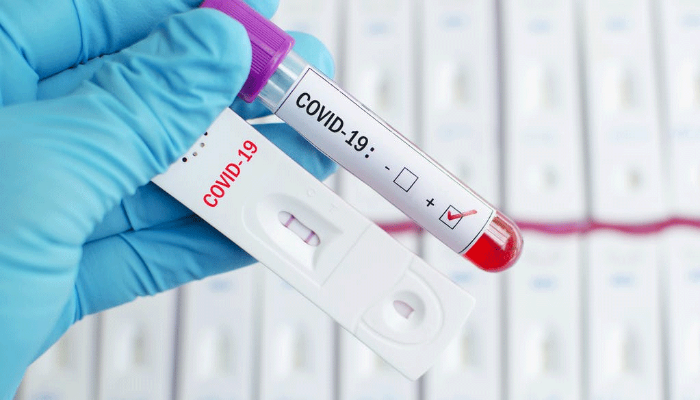 7 nouvelles infections et aucun décès ce dimanche 25 Septembre 7 nouvelles infections et aucun décès ce dimanche 25 Septembre